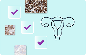 HER2 ICH Reporting Updates for Gynecologic Cancers