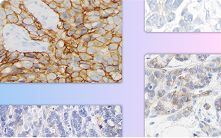 IHC-Atlas Thumbnail