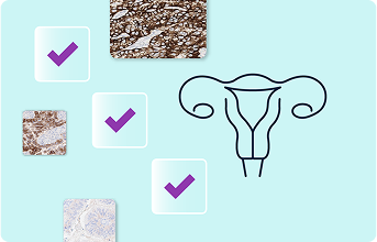 HER2 ICH Reporting Updates for Gynecologic Cancers
