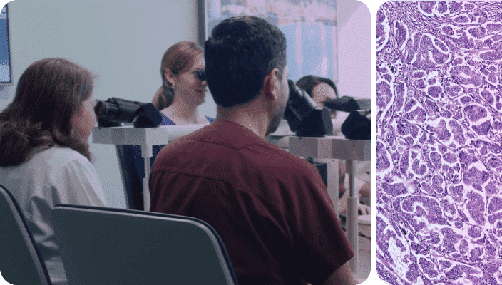 Breast Cancer Spotlight Series