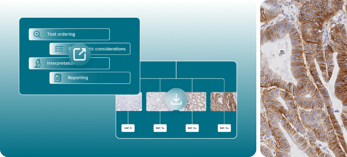 Gastric Cancer Resources