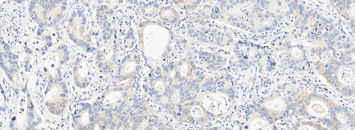 gastric resource hero image
