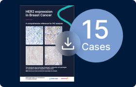 HER2 Expression in Breast Cancer: A Comprehensive Reference Guide