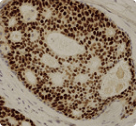 Decalcified Bone Specimen: Processing Procedures