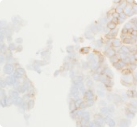 Recommendations For Testing Of Cytology Specimens