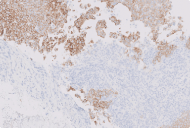 assessing-her2-ihc-with-edge-artifacts.png