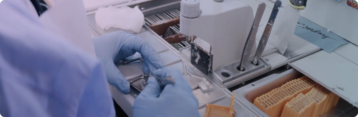 The importance of reporting discrete HER2 IHC scores