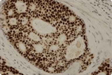 Decalcified Bone Specimen: Processing Procedures