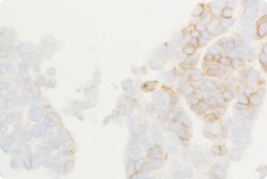 Recommendations For Testing Of Cytology Specimens