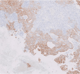 Assessing HER2 IHC with Edge Artifacts